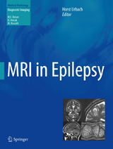 MRI in Epilepsy - 