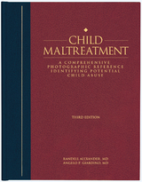 Child Maltreatment 3e, Volume 2 -  Randell Alexander,  Angelo P. Giardino