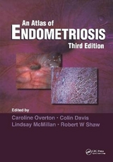 Atlas of Endometriosis - Overton, Caroline; Shaw, Robert W.; Mcmillan, Lindsay; Davis, Colin