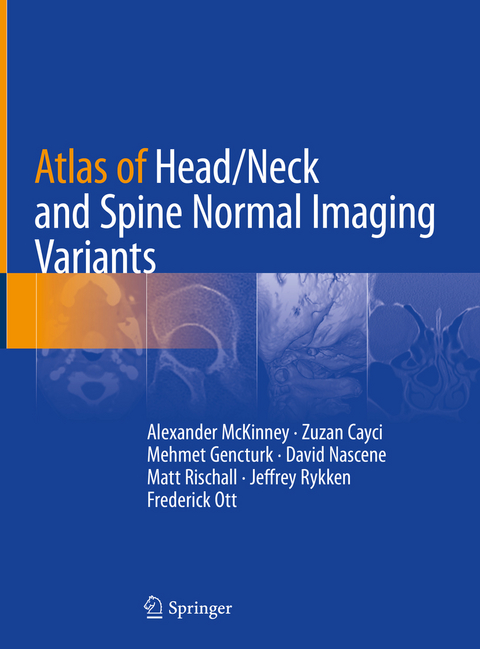 Atlas of Head/Neck and Spine Normal Imaging Variants - Alexander McKinney, Zuzan Cayci, Mehmet Gencturk, David Nascene, Matt Rischall, Jeffrey Rykken, Frederick Ott