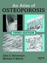 An Atlas of Osteoporosis - Stevenson, John C.; Marsh, Michael S.