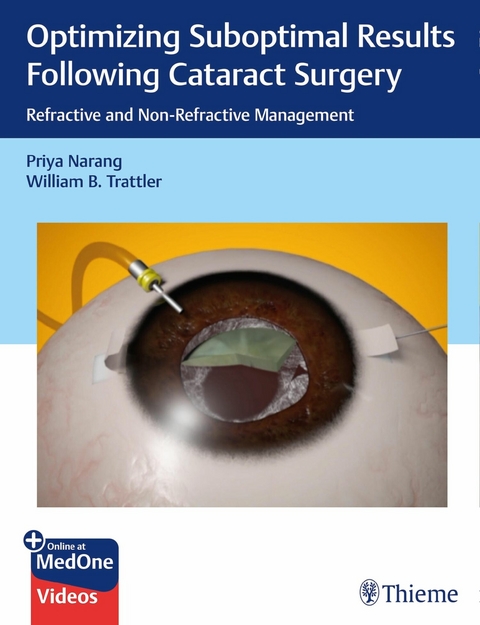 Optimizing Suboptimal Results Following Cataract Surgery -  Priya Narang,  William B. Trattler