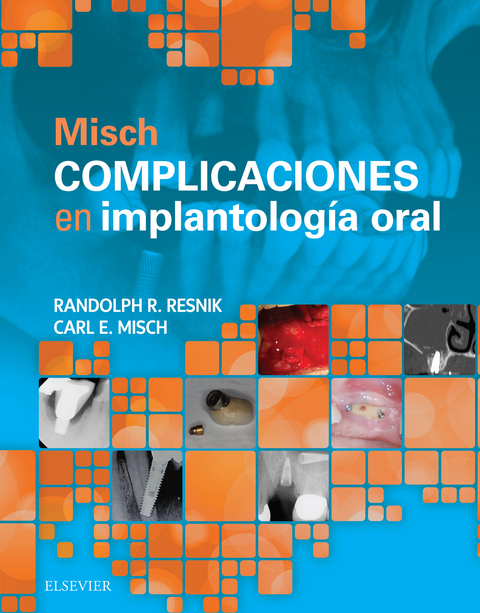 Misch. Complicaciones en implantología oral -  Carl E. Misch,  Randolph Resnik