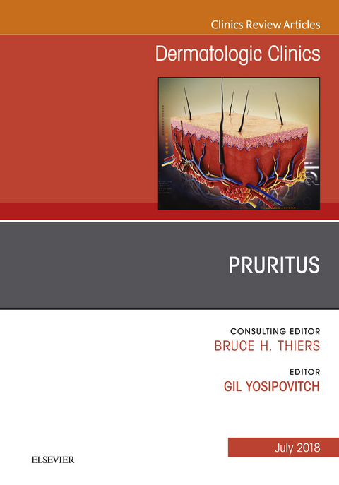 Pruritus, An Issue of Dermatologic Clinics -  Gil Yosipovitch