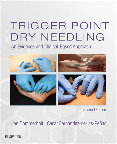 Trigger Point Dry Needling E-Book -  Jan Dommerholt,  Cesar Fernandez de las Penas