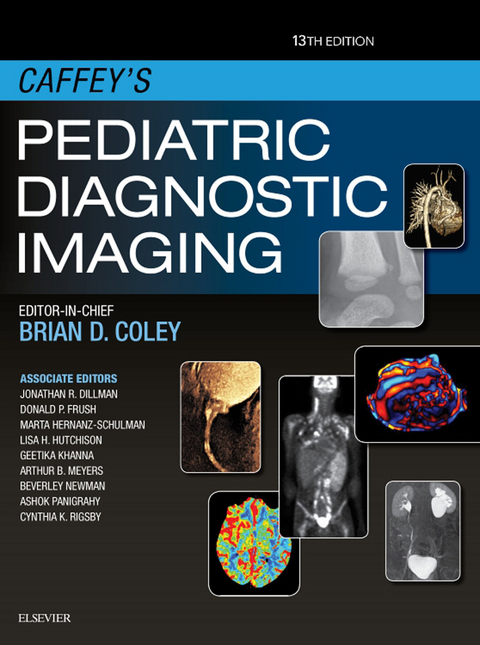 Caffey's Pediatric Diagnostic Imaging E-Book -  Brian D. Coley