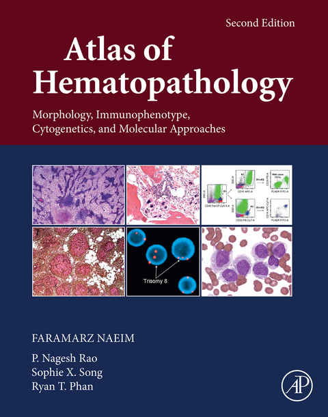 Atlas of Hematopathology -  Faramarz Naeim,  Ryan T. Phan,  P. Nagesh Rao,  Sophie X. Song