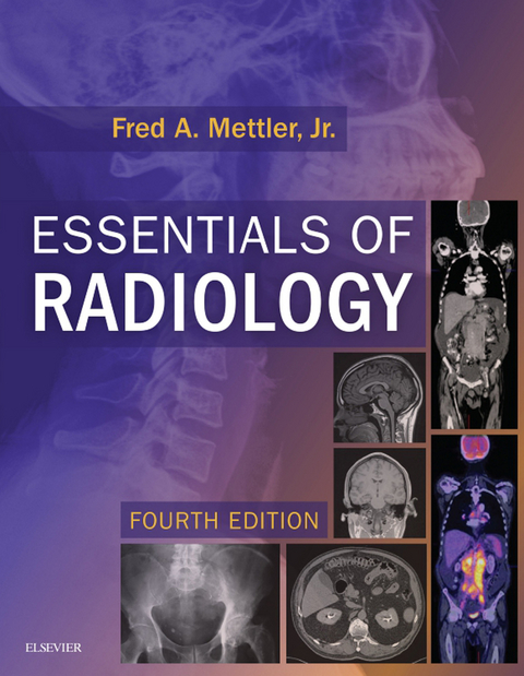 Essentials of Radiology E-Book -  Fred A. Mettler