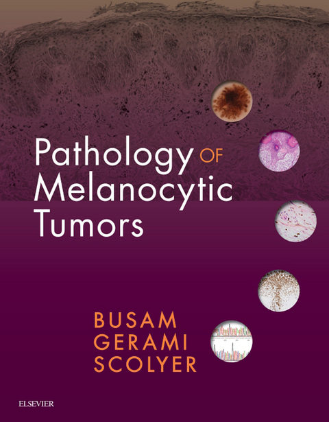 Pathology of Melanocytic Tumors E-Book -  Klaus J. Busam,  Pedram Gerami,  Richard A Scolyer