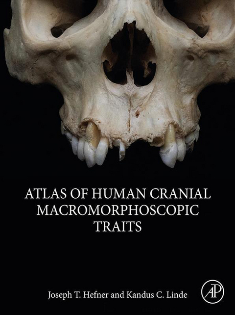 Atlas of Human Cranial Macromorphoscopic Traits -  Joseph T. Hefner,  Kandus C. Linde