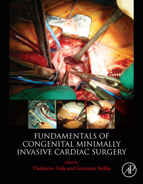 Fundamentals of Congenital Minimally Invasive Cardiac Surgery -  Giovanni Stellin,  Vladimiro Vida