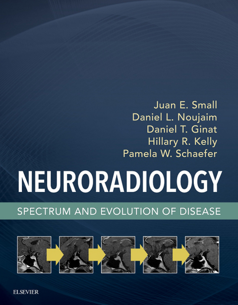 Neuroradiology -  Juan E. Small,  Daniel L. Noujaim,  Daniel T. Ginat,  Hillary R. Kelly,  Pamela W. Schaefer