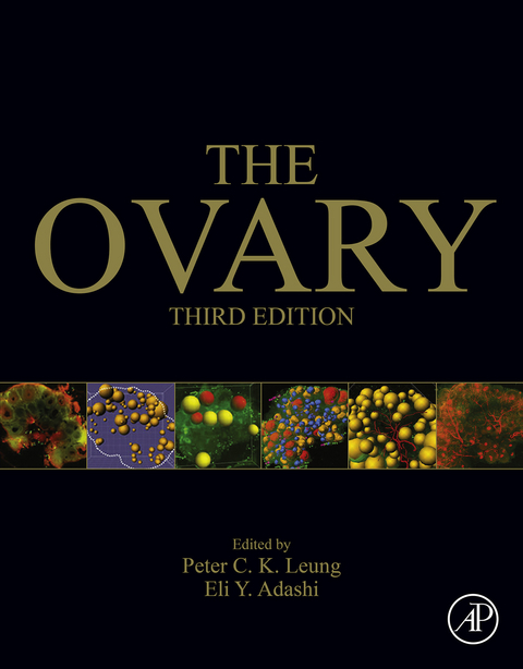 Ovary - 