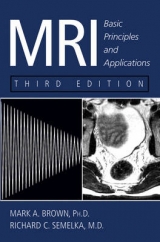 MRI - Brown, Mark A.; Semelka, Richard C.