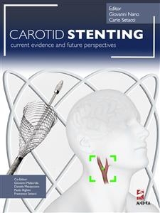 Carotid Stenting - Giovanni Nano, Carlo Setacci