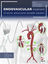 Endovascular treatment of aortic aneurysms: durable solution - Mauro Gargiulo, Giovanni Nano