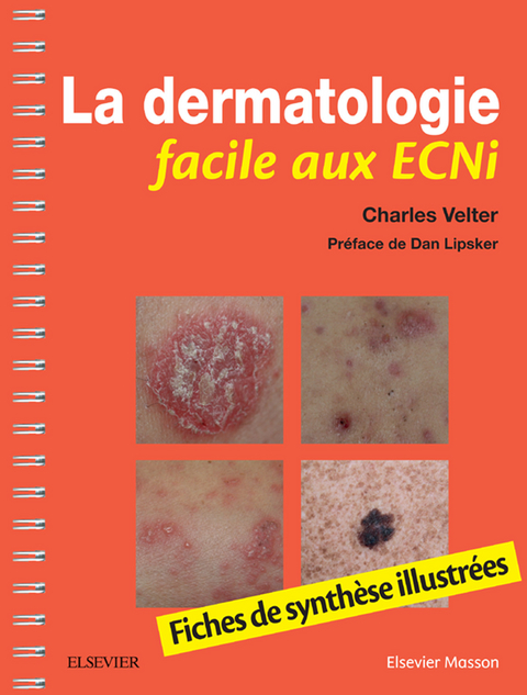 La dermatologie facile aux ECNi -  Charles Velter