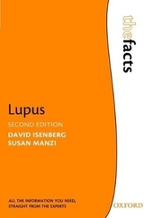 Lupus - Isenberg, David; Manzi, Susan