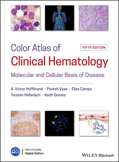 Color Atlas of Clinical Hematology - A. Victor Hoffbrand, Paresh Vyas, Elias Campo, Torsten Haferlach, Keith Gomez