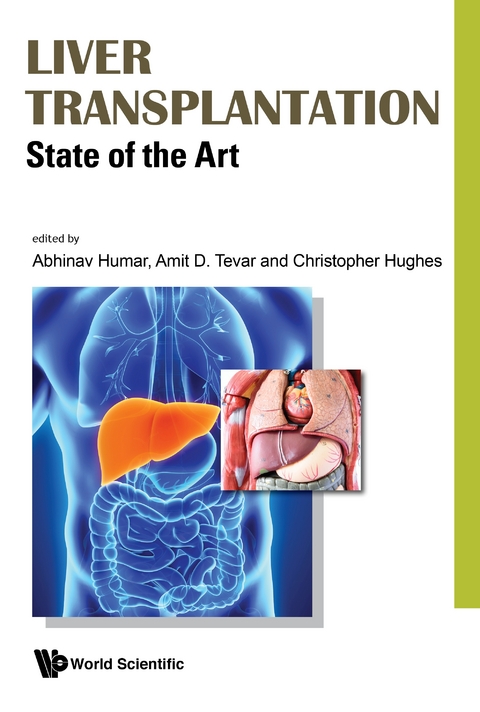 Liver Transplantation: State Of The Art - 