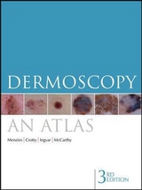 Dermoscopy - Menzies, Scott; Crotty, Kerry; Ingvar, Christian; McCarthy, William