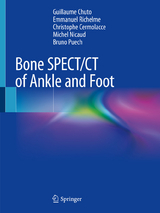 Bone SPECT/CT of Ankle and Foot - Guillaume Chuto, Emmanuel Richelme, Christophe Cermolacce, Michel Nicaud, Bruno Puech