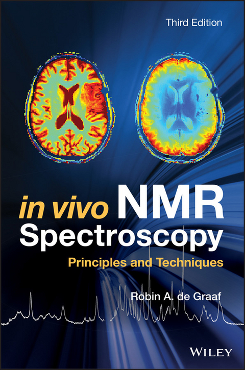 In Vivo NMR Spectroscopy - Robin A. de Graaf