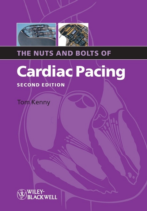 The Nuts and Bolts of Cardiac Pacing - Tom Kenny