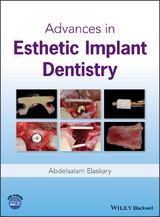 Advances in Esthetic Implant Dentistry - Abdelsalam Elaskary