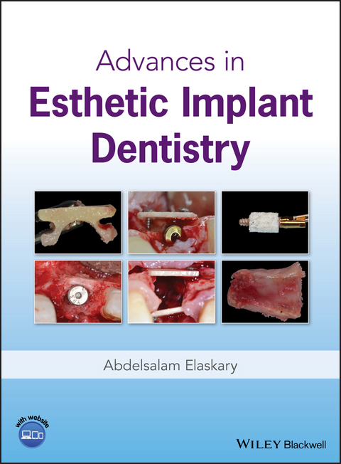 Advances in Esthetic Implant Dentistry - Abdelsalam Elaskary