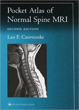 Pocket Atlas of Spinal MRI - Czervionke, Leo F.