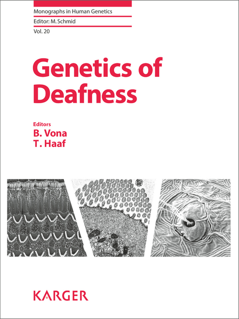 Genetics of Deafness - 