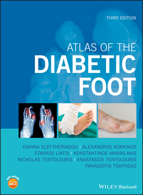 Atlas of the Diabetic Foot - Ioanna Eleftheriadou, Alexandros Kokkinos, Stavros Liatis, Konstantinos Makrilakis, Nicholas Tentolouris, Anastasios Tentolouris, Panagiotis Tsapogas