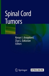 Spinal Cord Tumors - 