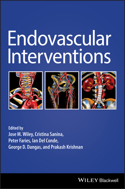 Endovascular Interventions - 