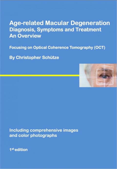 Age-related macular degeneration - Christopher Schütze