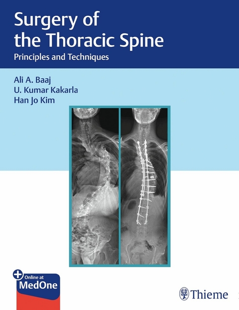 Surgery of the Thoracic Spine -  Ali A. Baaj,  U. Kumar Kakarla,  Han Jo Kim