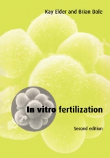 In Vitro Fertilization - Elder, Kay; Dale, Brian