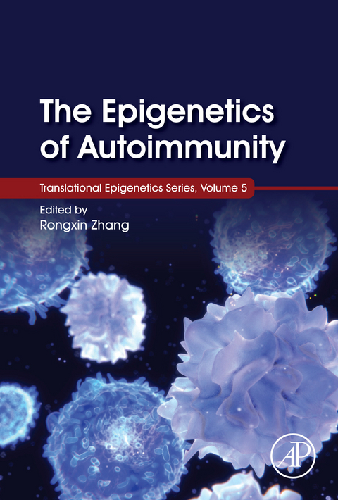 Epigenetics of Autoimmunity - 