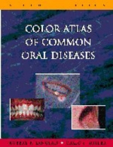 Color Atlas of Common Oral Diseases - Langlais, Robert P.; Miller, Craig S.