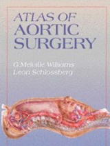 Atlas of Aortic Surgery - Williams, George M.; Schlossberg, Leon