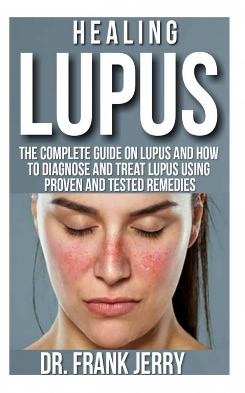 Healing Lupus -  Dr Frank Jerry