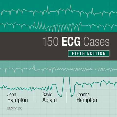 150 ECG Cases -  David Adlam,  Joanna Hampton,  John Hampton