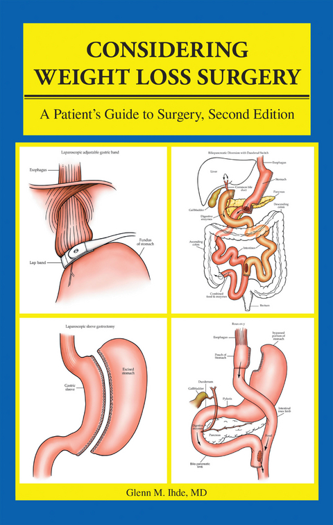 Considering Weight Loss Surgery - Glenn M. Ihde MD