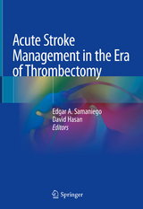 Acute Stroke Management in the Era of Thrombectomy - 