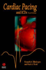 Cardiac Pacing and Icds - Ellenbogen