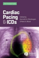 Cardiac Pacing and ICDs - Ellenbogen, Kenneth A.; Wood, Mark A.