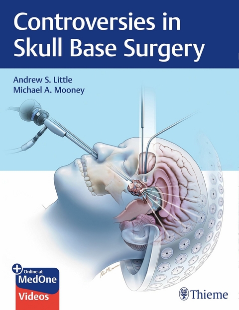 Controversies in Skull Base Surgery -  Andrew S. Little,  Michael A. Mooney