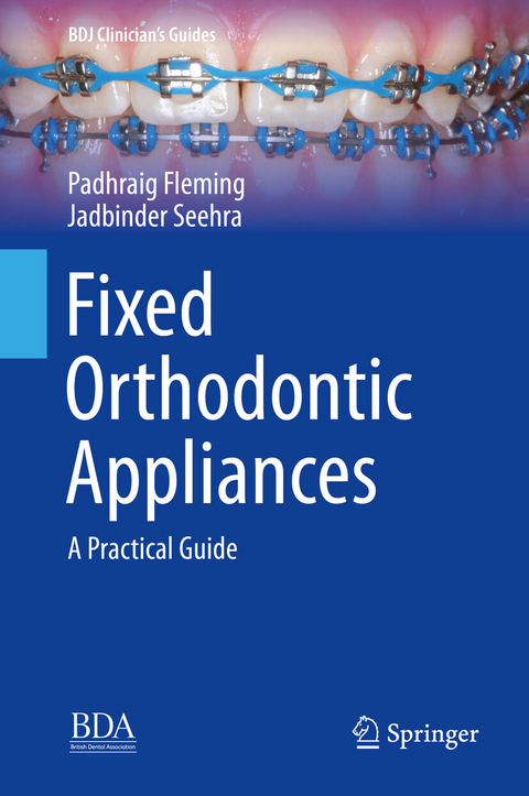 Fixed Orthodontic Appliances - Padhraig Fleming, Jadbinder Seehra