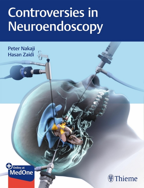 Controversies in Neuroendoscopy -  Peter Nakaji,  Hasan A. Zaidi